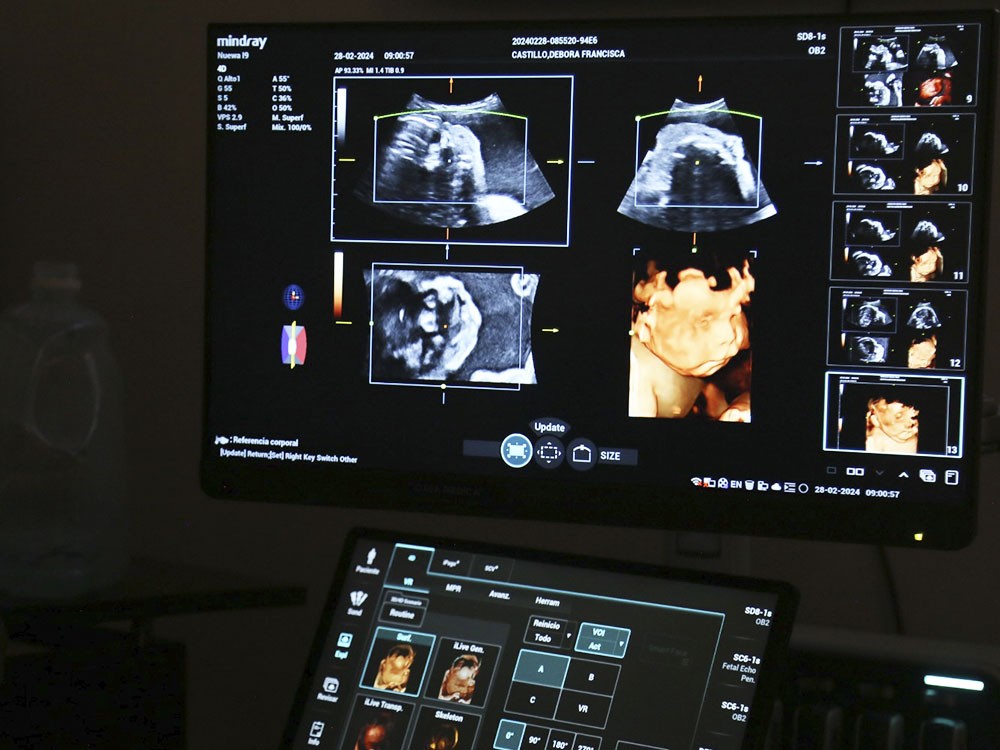 Hospital Regional de Occidente adquiere equipo médico de alta tecnología para la atención de mujeres embarazadas 