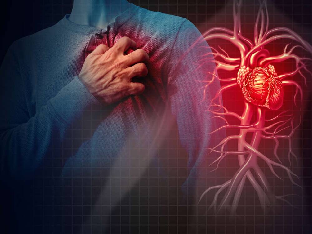 Los cardiólogos están en alerta por el preocupante aumento de infartos en personas jovenes 