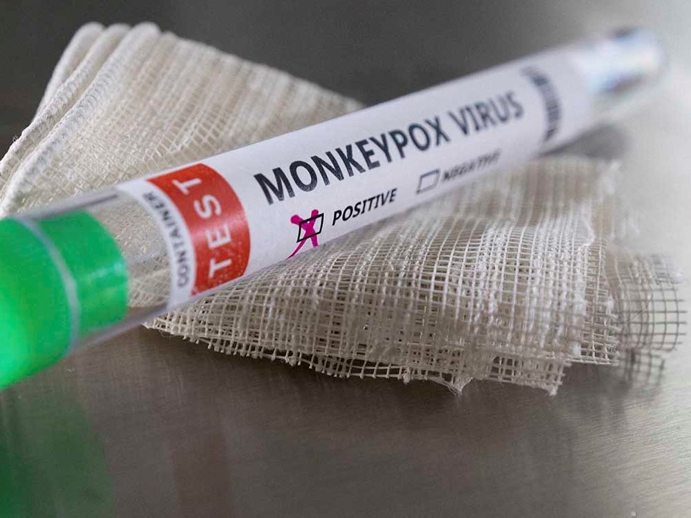 MSPAS lanza Alerta Institucional por dos nuevos casos de Viruela del Mono